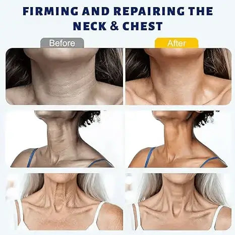 ✨ Instant Neck Lift Cream — 🧴 Infused with Retinol & Hyaluronic Acid | Firms the Neck, Reduces Wrinkles & Double Chin